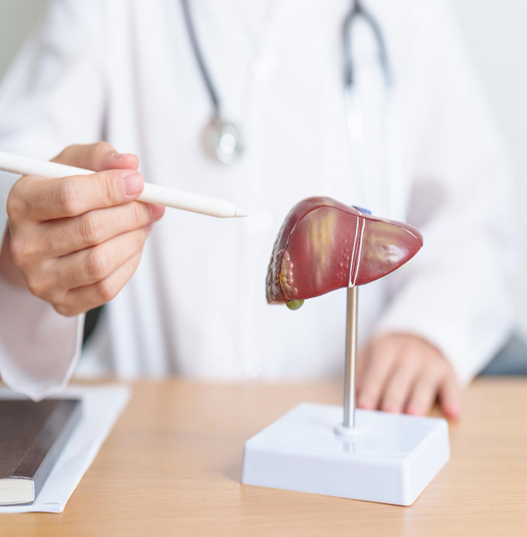 Ayurvedic multi-herbal therapeutic strategies for hepatic cirrhosis with ascites